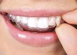 Align your Teeth with Invisible Teeth Braces