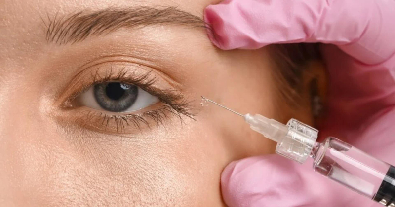 Under Eye Fillers in Dubai: How to Choose the Right Filler Type