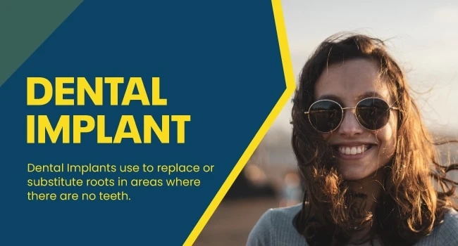 Advantages and Types of Dental Implants