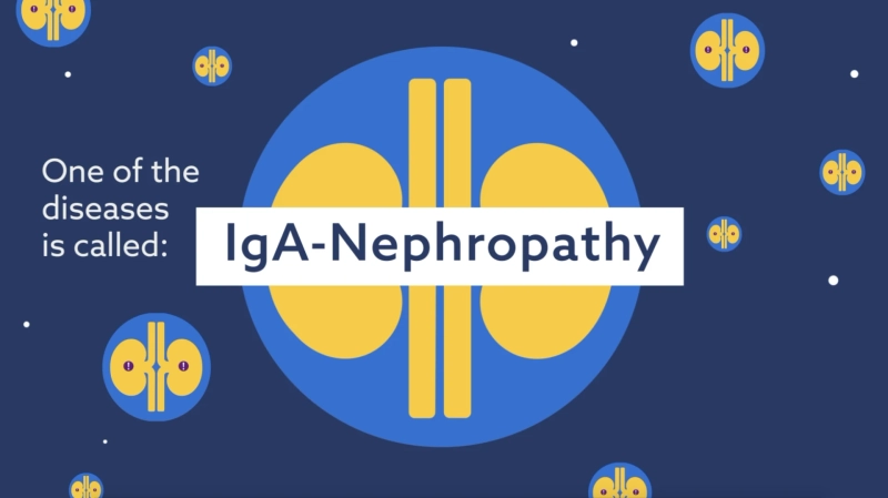 Regular Solutions for Kidney Infection