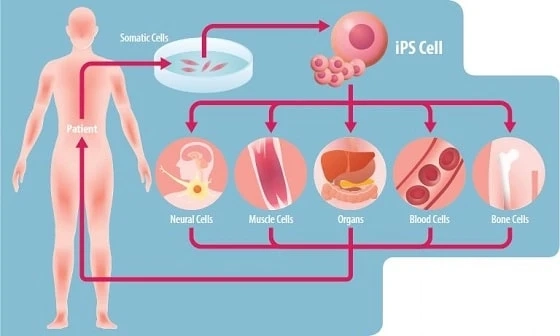 After the Stem Cell Transplant