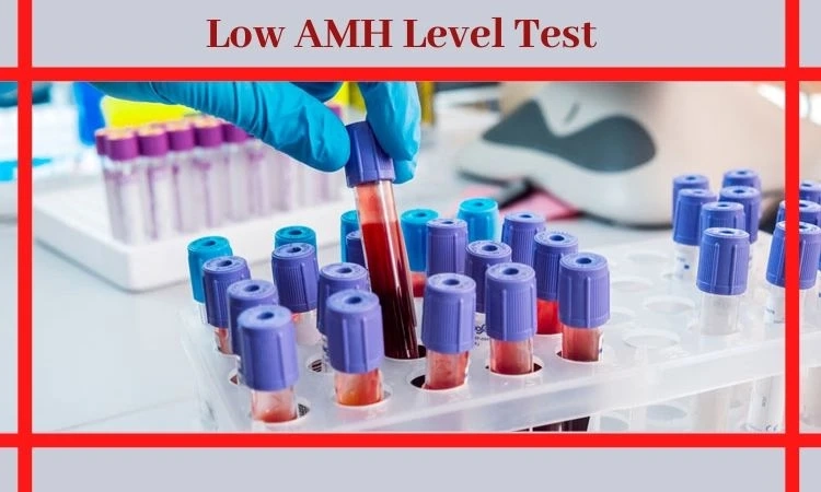How low is too low AMH level when we talk about different AMH levels?