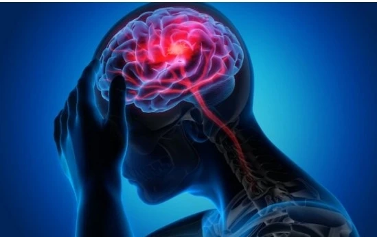 Neurologist South Delhi