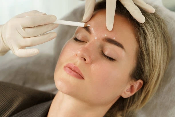 Can I Get Botox and Fillers During the Same Session?