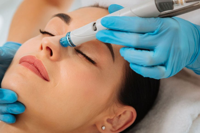 Hydrafacial Brilliance: The Key to Flawless Skin