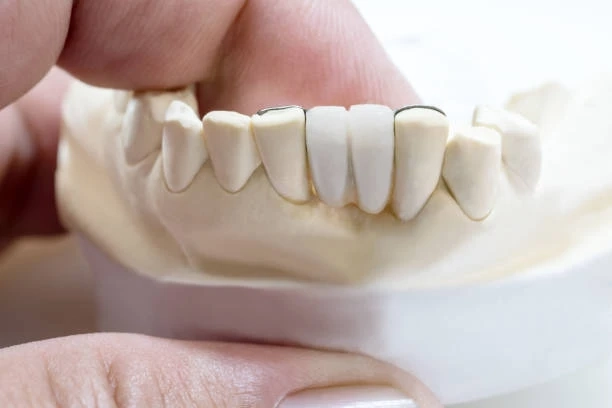 The Role of an Implant Dentist in Modern Tooth Replacement