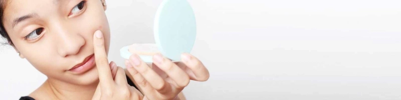 How to Get Rid of Chin Acne, According to Dermatologist