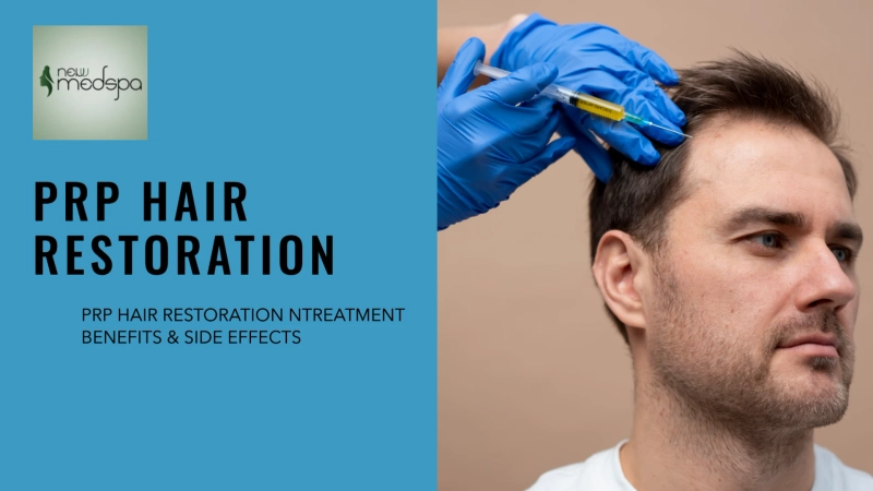 PRP Hair Restoration