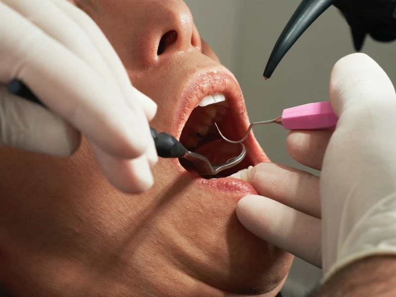 Cosmetic dentistry has several advantages