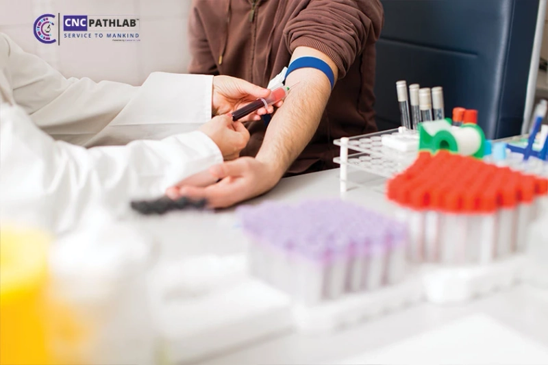 Get Accurate and Convenient Blood Test Results with Home Collection