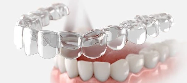 Top Providers in the Clear Aligners Market