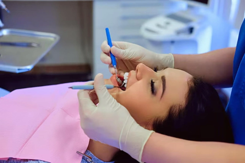 The Procedure for Tooth-Colored Fillings in Powder Springs