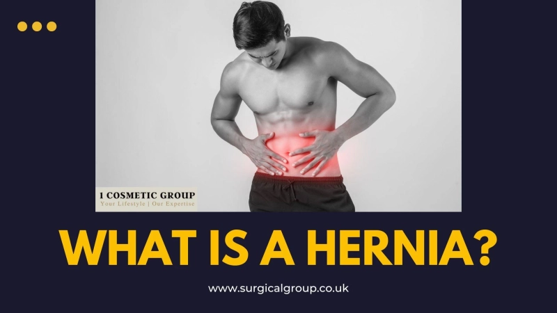 What is a hernia?