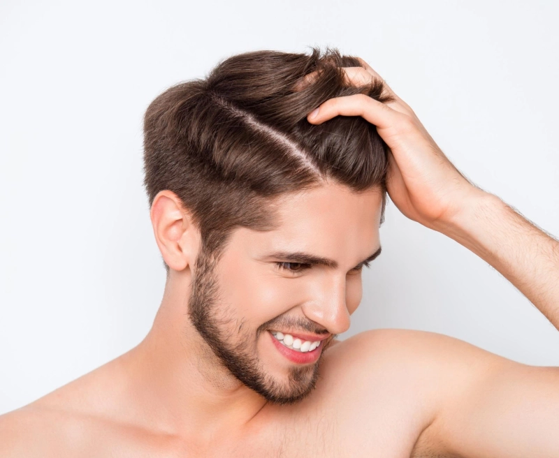 Are there any non-surgical alternatives to hair transplant?