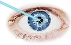 Ophthalmic Femtosecond Lasers Market Research 2021 New Report | Growth Forecast 2030 | GET FLAT 20%