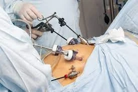 what is Bariatric Surger