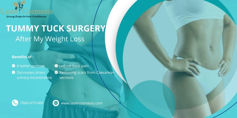 Do I Need A Tummy Tuck After My Weight Loss Surgery?