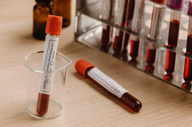 For the collection and diagnosis of blood-related diseases, blood collection tubes are used