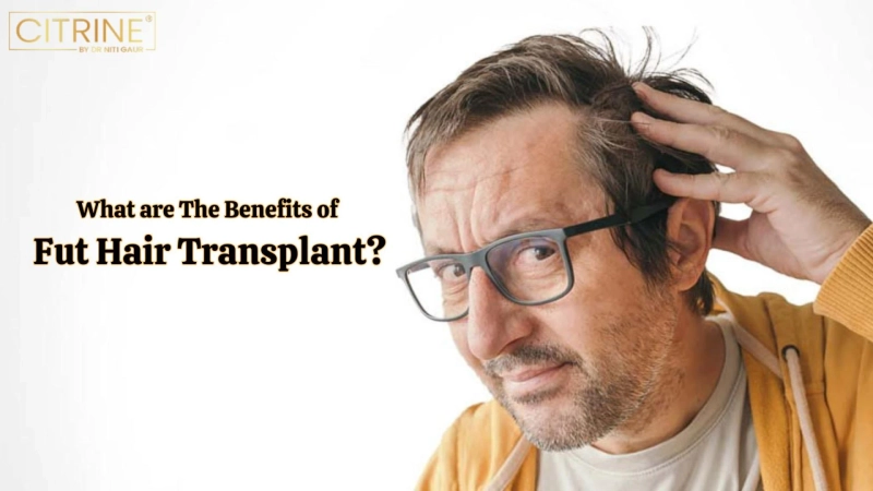 What Are The Benefits of FUT Hair Transplant?