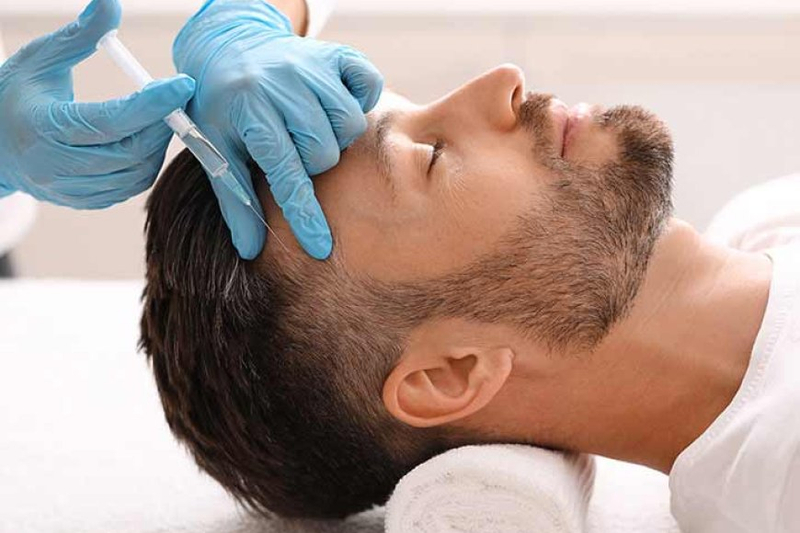 Stress and Hair Loss: Are They Related?