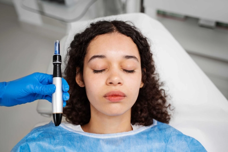 How Many Sessions of RF Microneedling Do You Really Need?