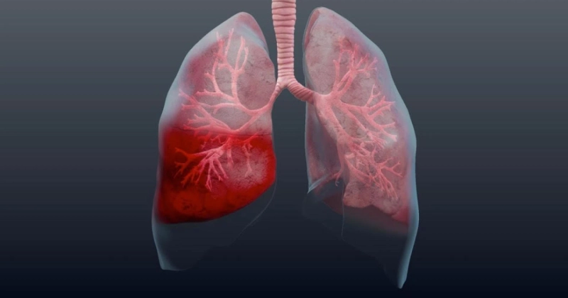 Forecasting 2022-2028: Global Pneumonia Testing Market trends, share, size, growth, opportunities, and forecasts