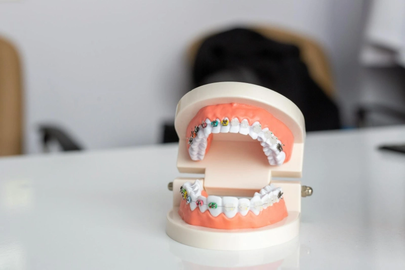 Tooth Extraction Aftercare: Complete Guide for Safe Healing
