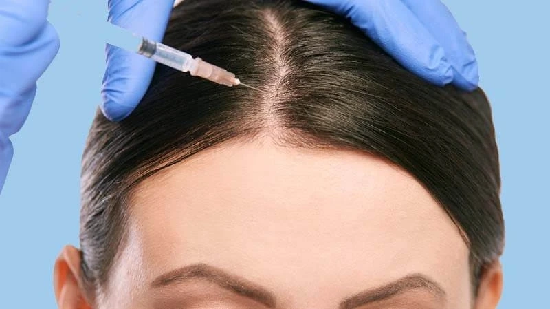 Hair Loss Treatment in Dubai That Gives You the Hair You Deserve
