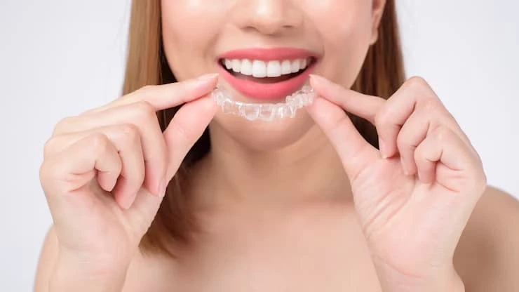 Why Invisalign Wolverhampton Is the Preferred Choice for Adults & Teens