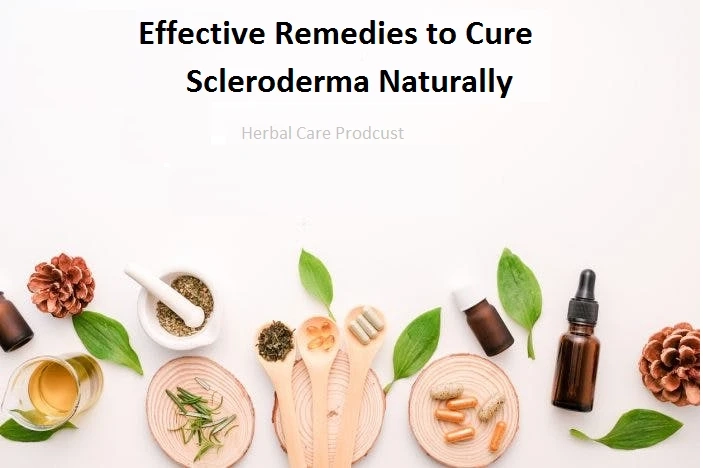 Effective Remedies to Cure Scleroderma Naturally