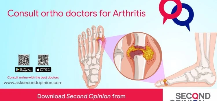 Consult orthopedic doctors online for Arthritis