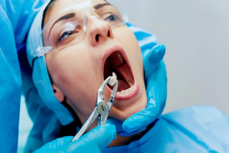 Emergency Tooth Extractions Thousand Oaks Services