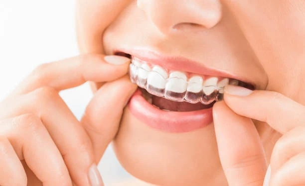 Staying Comfortable and Consistent with Invisalign Treatment