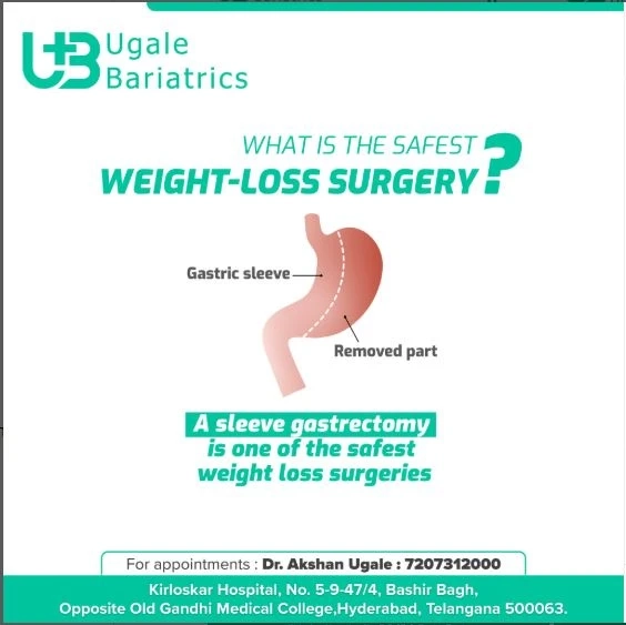 Is the Gastric Sleeve Safe? Everything You Need to Know