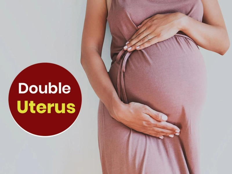 Double Uterus - Symptoms, Causes, and Treatment