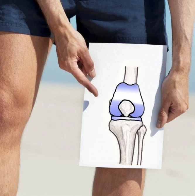 Total Knee Replacement in India - Shalby Hospitals