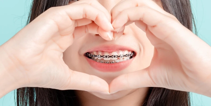 Where can I get braces in Islamabad?