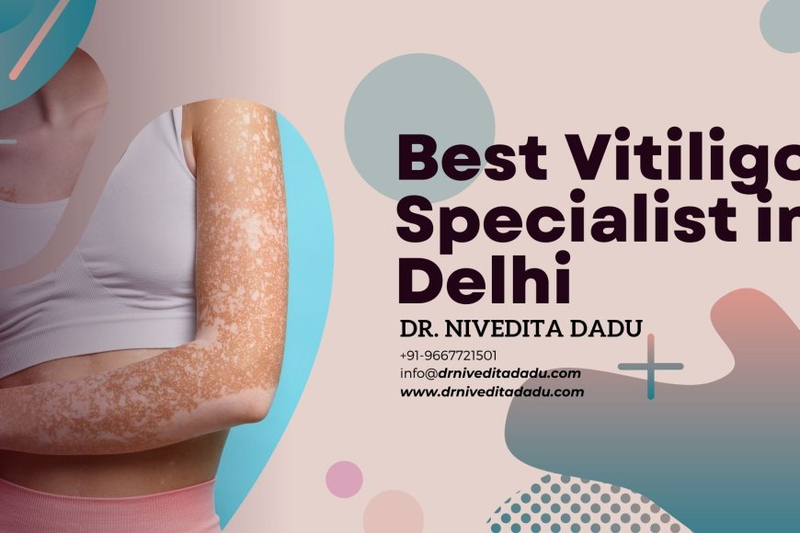 Myths & Facts About Vitiligo