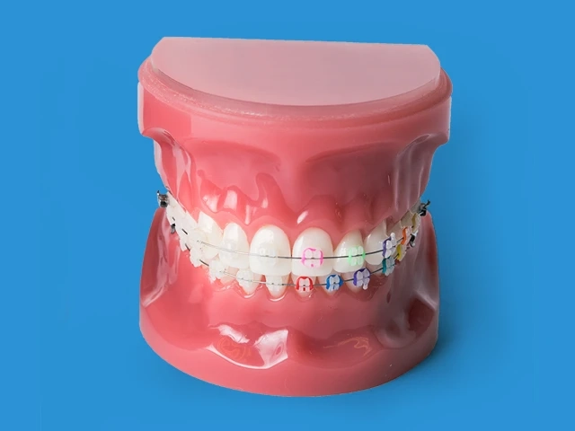What Makes Invisalign the Preferred Option in Rockwall ?