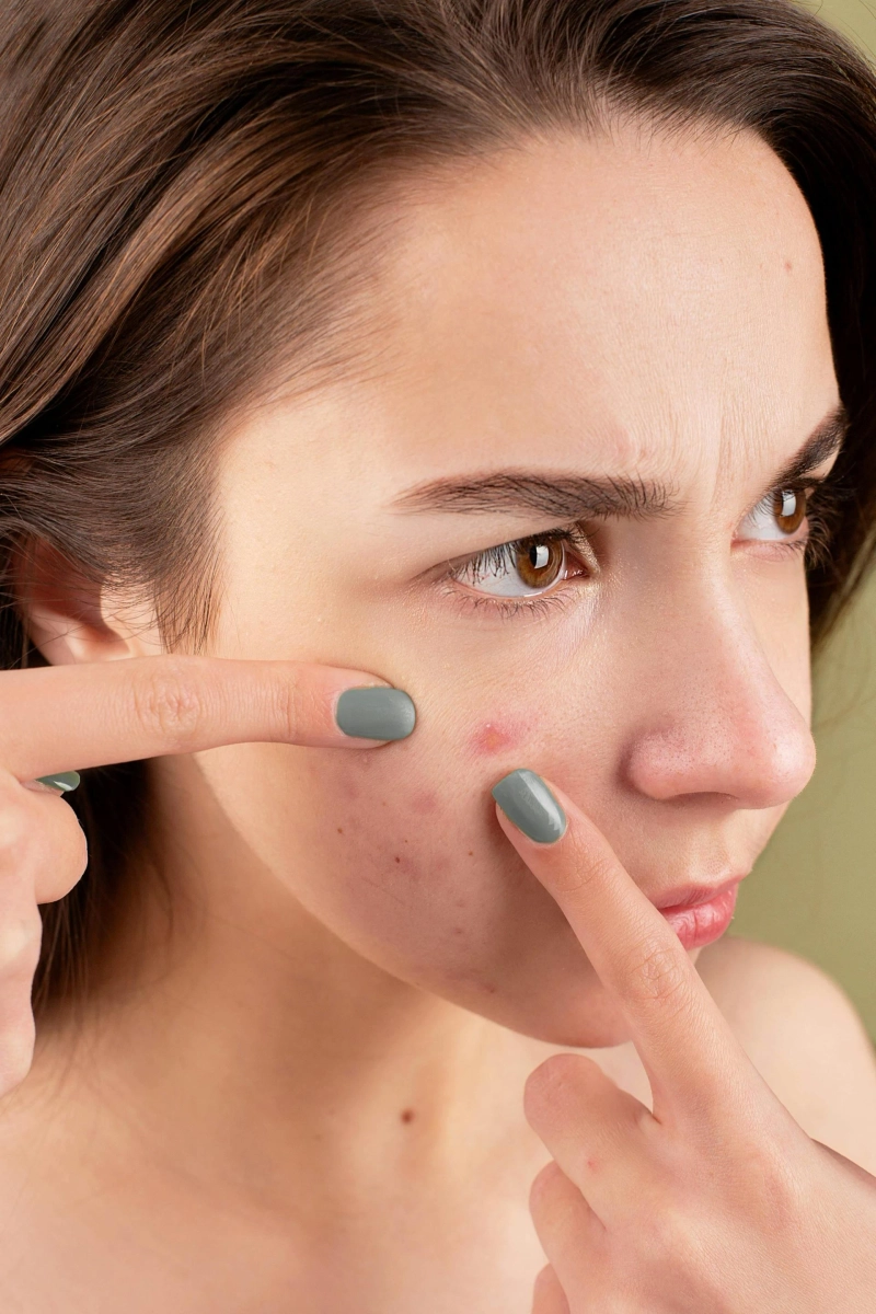 Smooth Skin, Fuller Lips & Zero Hair: Weybridge’s Aesthetic Treatments You Need to Try