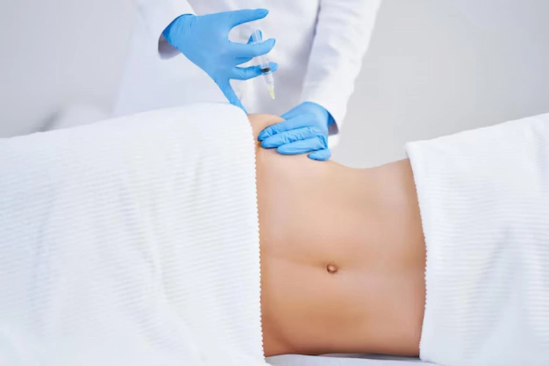 Best Fat Freezing Clinics in Birmingham