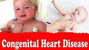 Genesis Foundation India: Helping children with Congenital Heart Defects