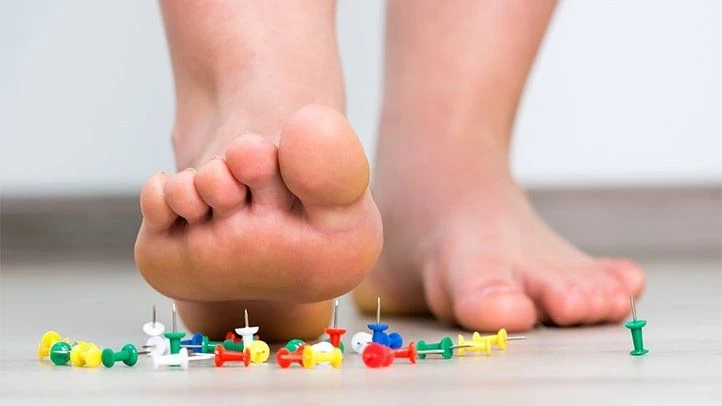 Treatment for Neuropathy: 5 Natural and Home Remedies