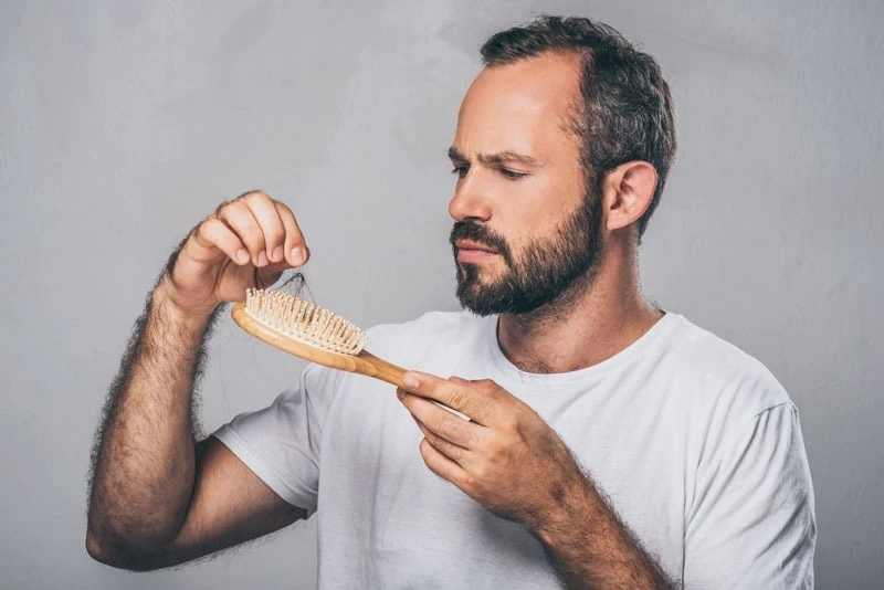 Advanced Hair Loss Treatment Delhi: How Exosome Therapy Works
