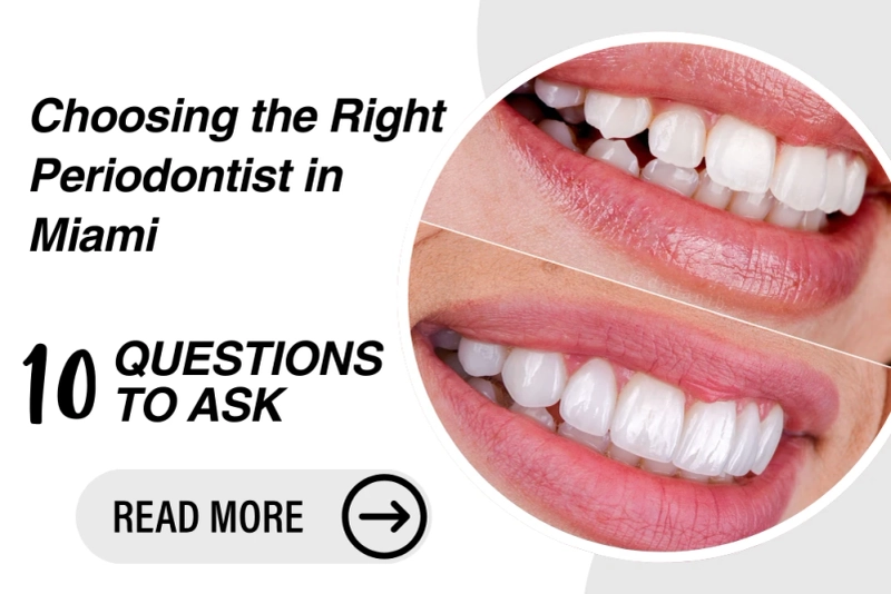 Choosing the Right Periodontist in Miami: 10 Questions to Ask