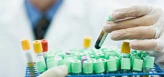Autoimmune Disease Diagnostics Market by Type, Share, Application and Forecast Till 2027