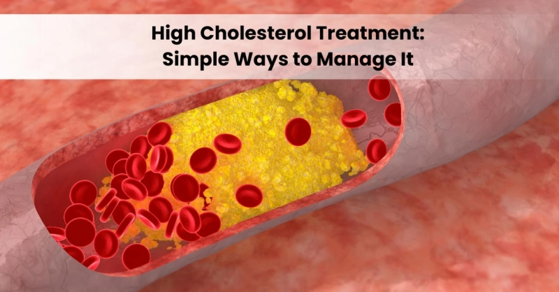 High Cholesterol Treatment: Simple Ways to Manage It
