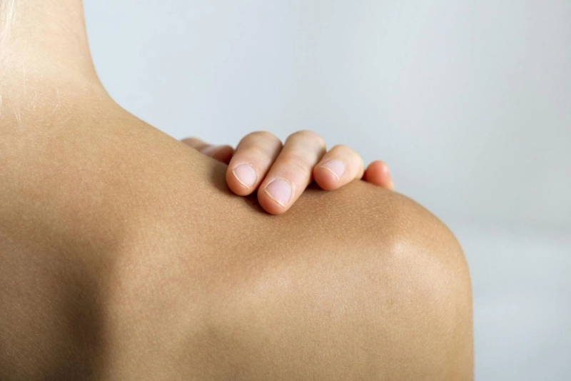 Stretch Mark Treatment - Biological Technique