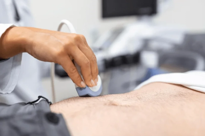 Best Penile Implant Clinic in London – Dr. Giulio Garaffa’s Expertise