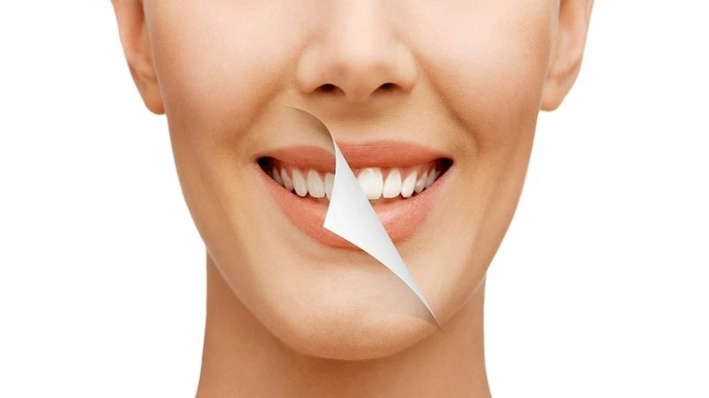What To Expect After Teeth Whitening Services in Windsor